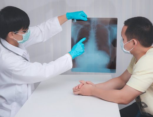 Best Lung Cancer Treatment Singapore