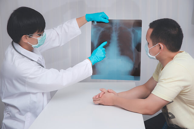 Best Lung Cancer Treatment Singapore